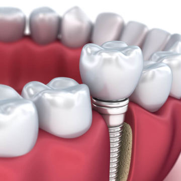 Медицинский туризм